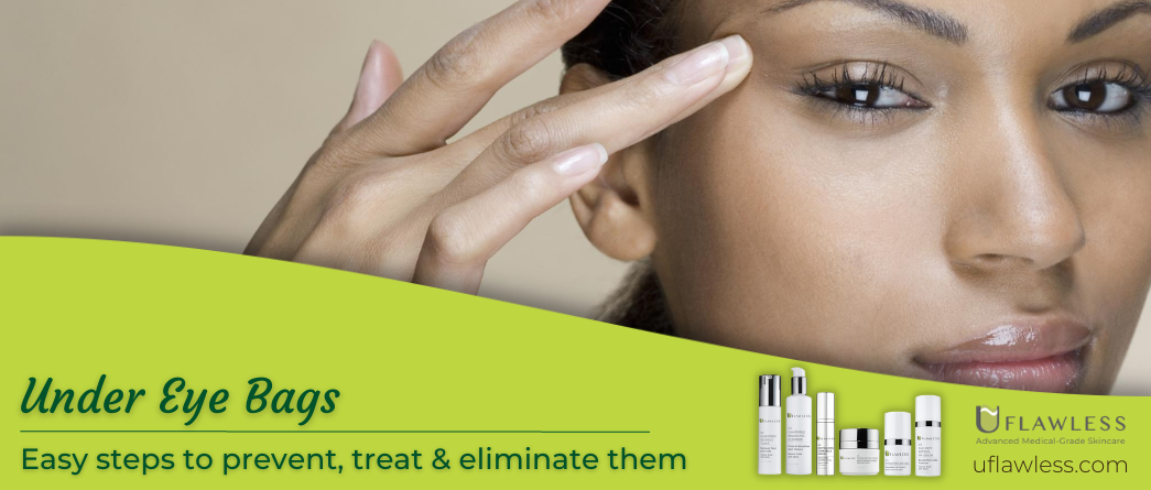 Under Eye Bags – Easy steps to prevent, treat & eliminate them