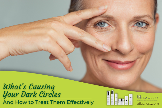 What's causing your dark circles and how to treat them effectively