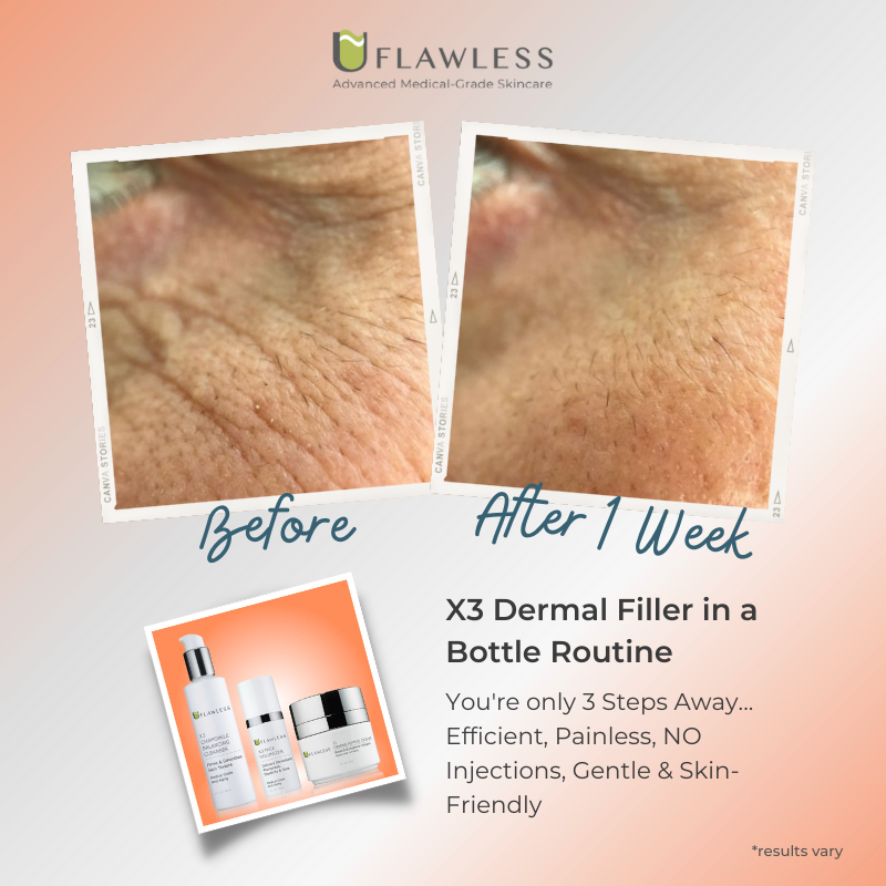 X3 Face Volumizer | Anti-Aging Skincare