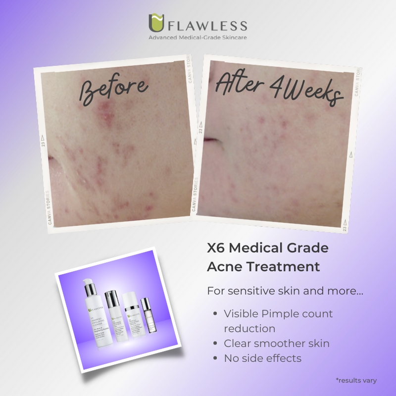 X6 Matcha Mattifying Serum | Skin Care Serum