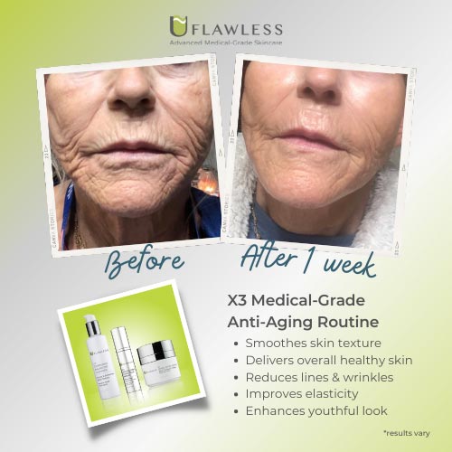 X3 14-Day Transformation Kit | Travel Size Skincare