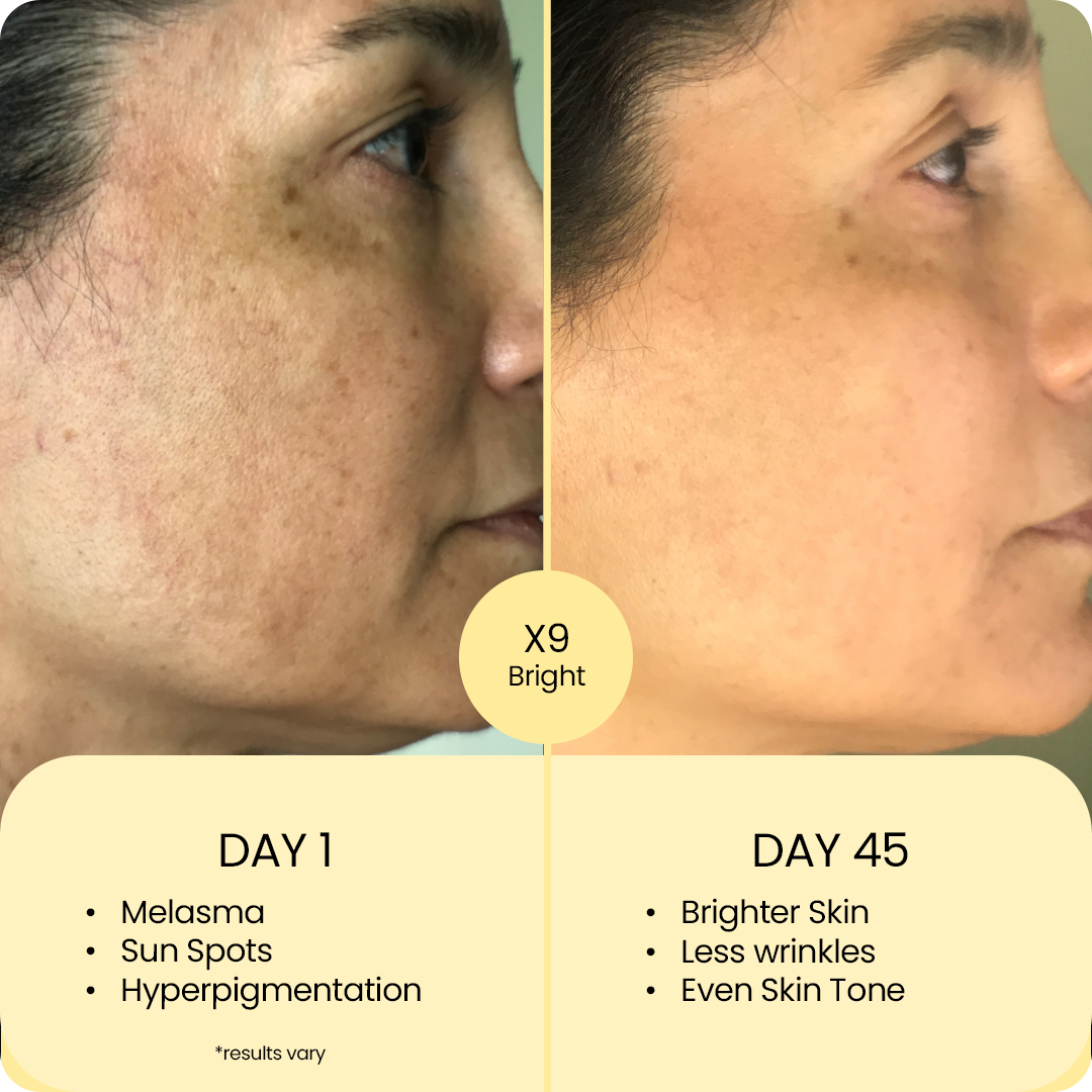 X9 Advanced Brightening Routine | Hydroquinone-Free