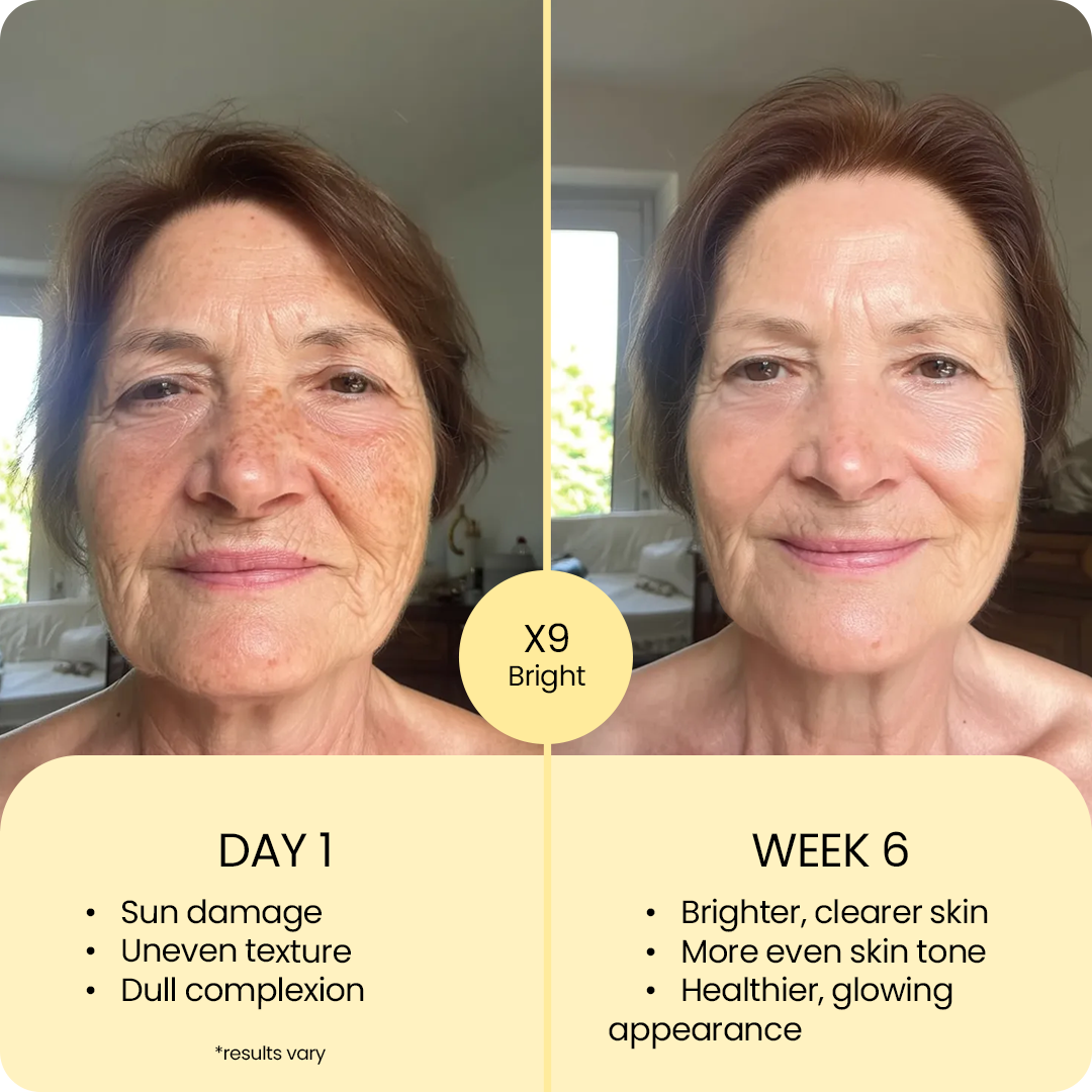 X9 Ultimate Brightening Moisturizer