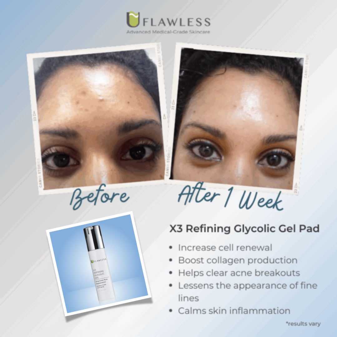 X3 Refining Glycolic Gel | Exfoliating Gel Low pH