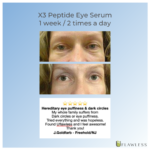 X3 Eye Testimonial