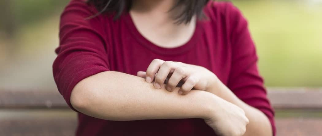 itchy skin could be the laundry detergent