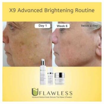 X9 Advanced Brightening Routine