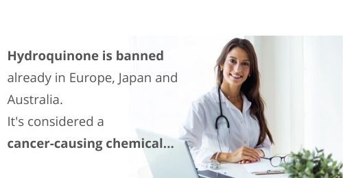 Hydroquinone banned in Europe, Japan and Australia