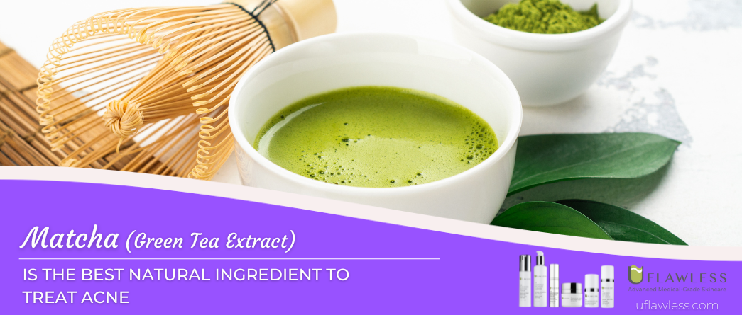 Matcha is the safest natural ingredient to treat acne