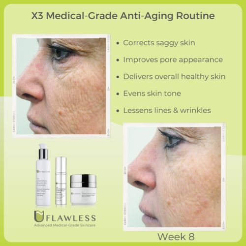 X3 Medical-Grade Anti-Aging Rouine