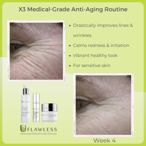 X3 Medical-Grade Anti-Aging Rouine