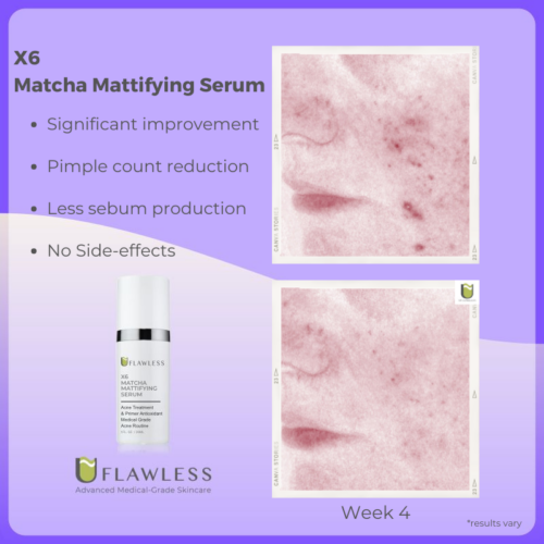 X6 Matcha Mattifying Serum