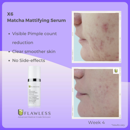 X6 Matcha Mattifying Serum