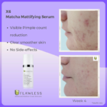 X6 Mattify B&A IV copy