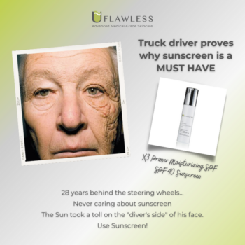 Truck Driver proves why sunscreen is a must have