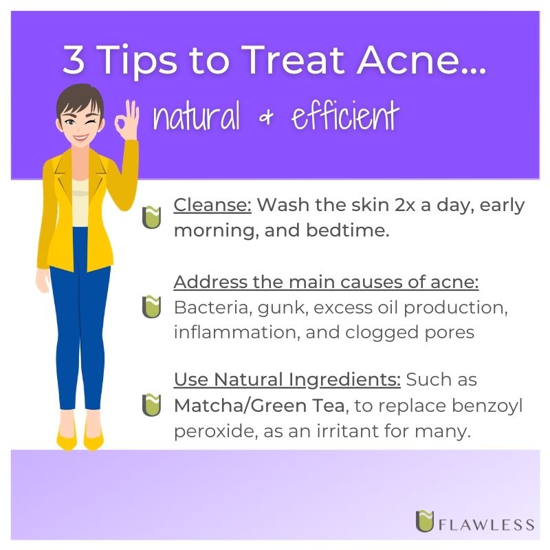 Tips to treat acne
