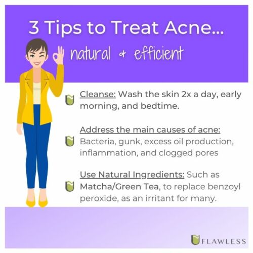 3 Tips To Treat Acne and Blackheads